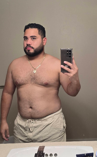 Carlos R. después del tratamiento