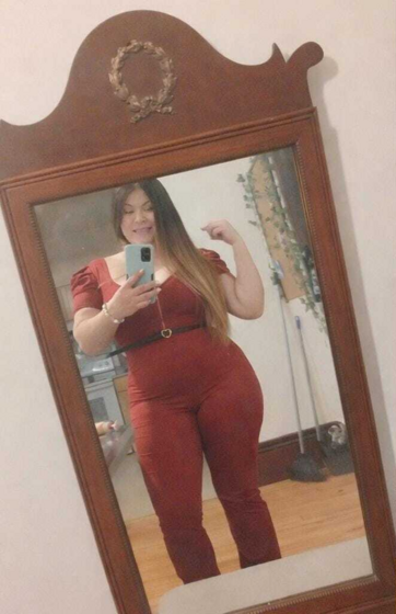Verónica S. antes del tratamiento