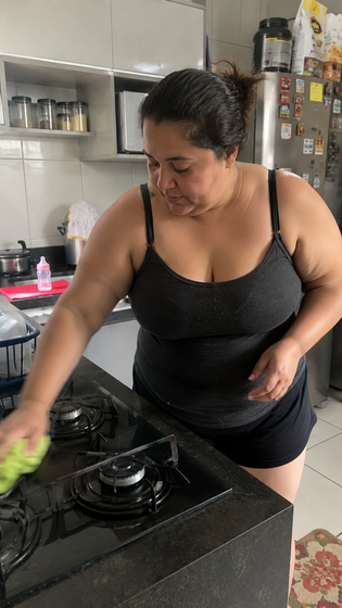 Solange P. antes del tratamiento