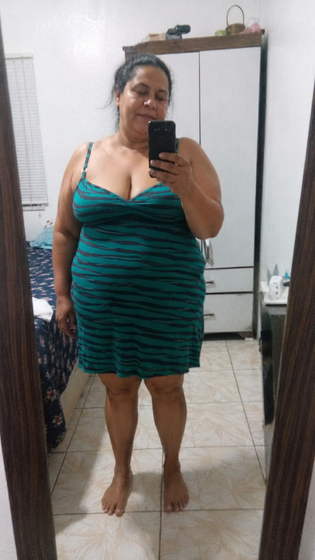 Rosária L. antes del tratamiento